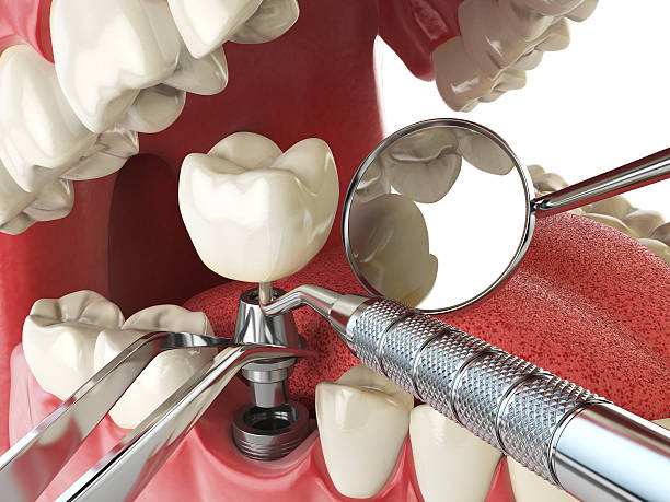 Best Emergency Dental Surgery in Ellisville, MO